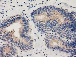 HDAC6 Antibody in Immunohistochemistry (Paraffin) (IHC (P))