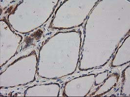 HDAC6 Antibody in Immunohistochemistry (Paraffin) (IHC (P))