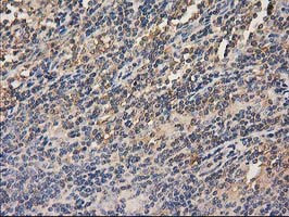 HDAC6 Antibody in Immunohistochemistry (Paraffin) (IHC (P))