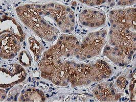 HDAC6 Antibody in Immunohistochemistry (Paraffin) (IHC (P))