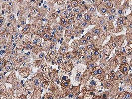 HDAC6 Antibody in Immunohistochemistry (Paraffin) (IHC (P))