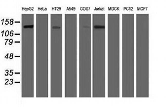 HDAC6 Antibody in Western Blot (WB)