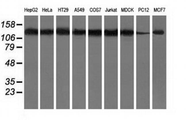 HDAC6 Antibody in Western Blot (WB)