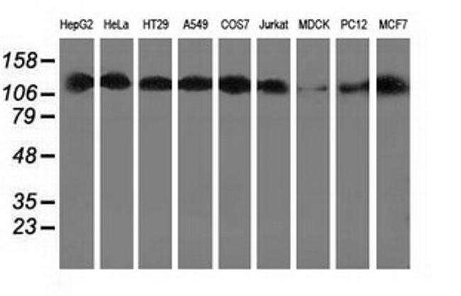 HDAC6 Antibody in Western Blot (WB)