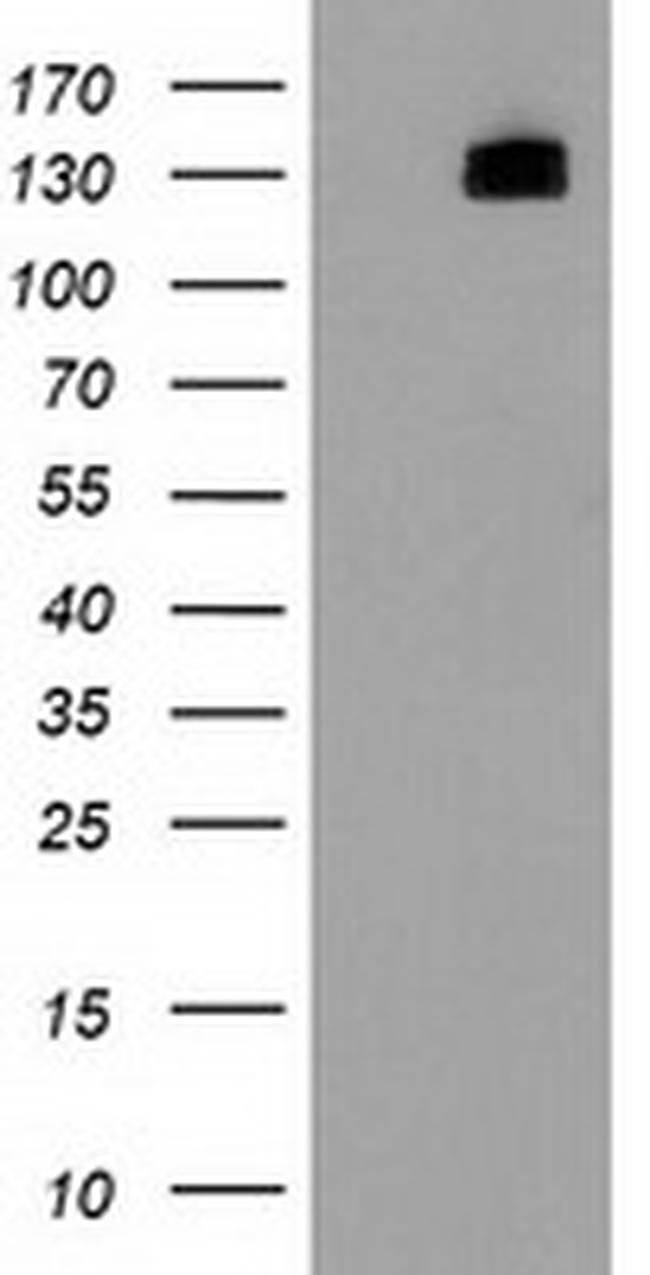 HDAC6 Antibody in Western Blot (WB)