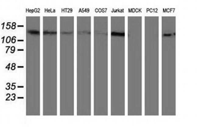 HDAC6 Antibody in Western Blot (WB)