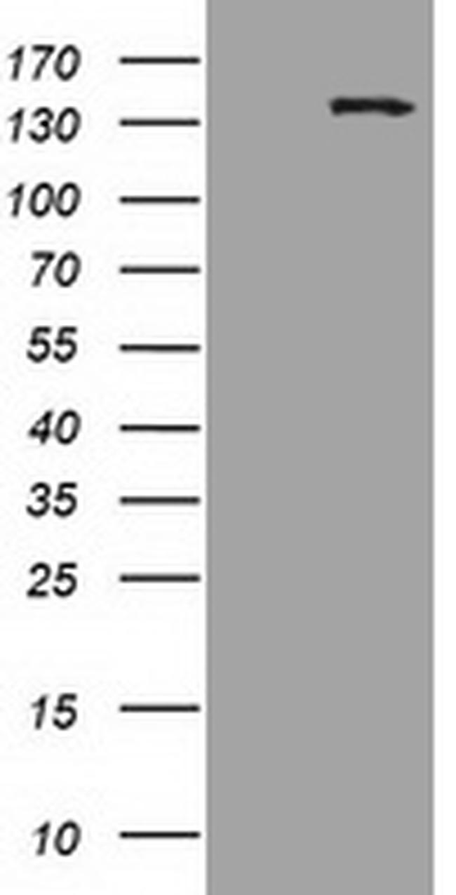 HDAC6 Antibody in Western Blot (WB)