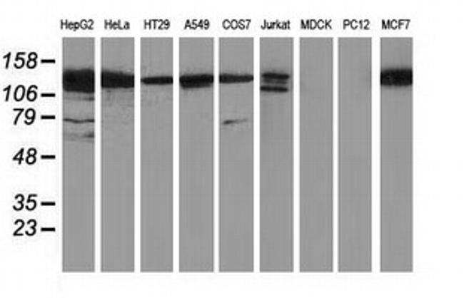 HDAC6 Antibody in Western Blot (WB)