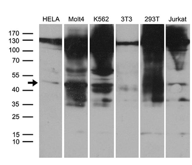 HDAC8 Antibody in Western Blot (WB)