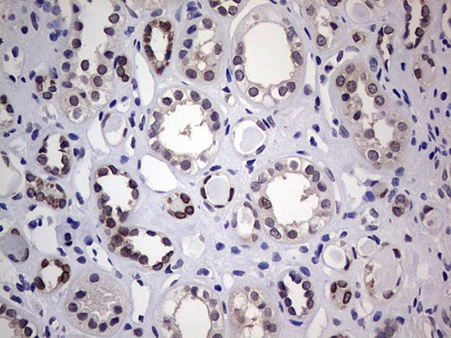 HDAC9 Antibody in Immunohistochemistry (Paraffin) (IHC (P))