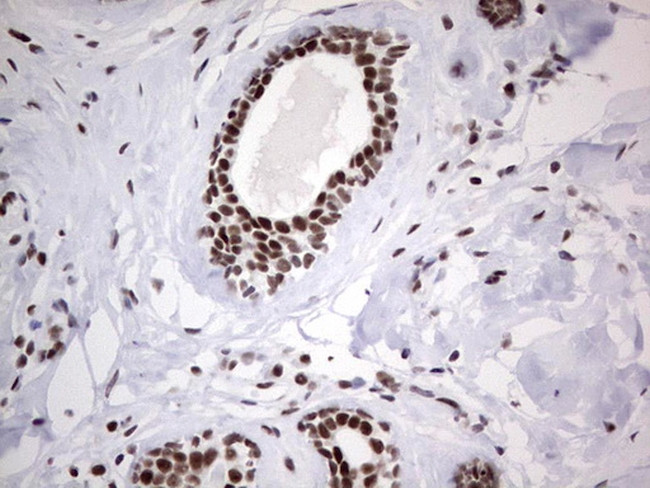 HDAC9 Antibody in Immunohistochemistry (Paraffin) (IHC (P))