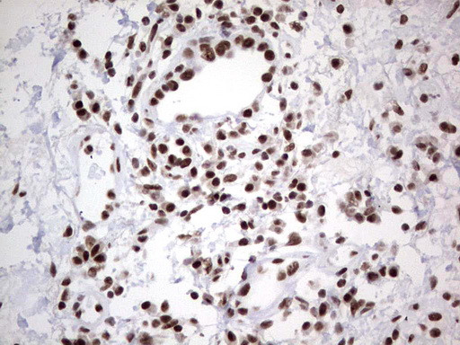 HDAC9 Antibody in Immunohistochemistry (Paraffin) (IHC (P))