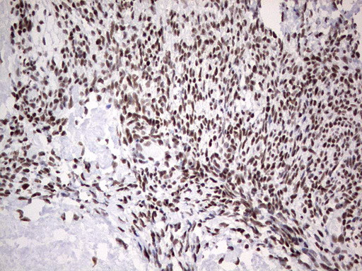 HDAC9 Antibody in Immunohistochemistry (Paraffin) (IHC (P))