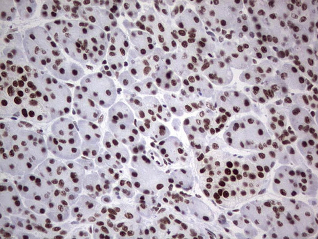 HDAC9 Antibody in Immunohistochemistry (Paraffin) (IHC (P))