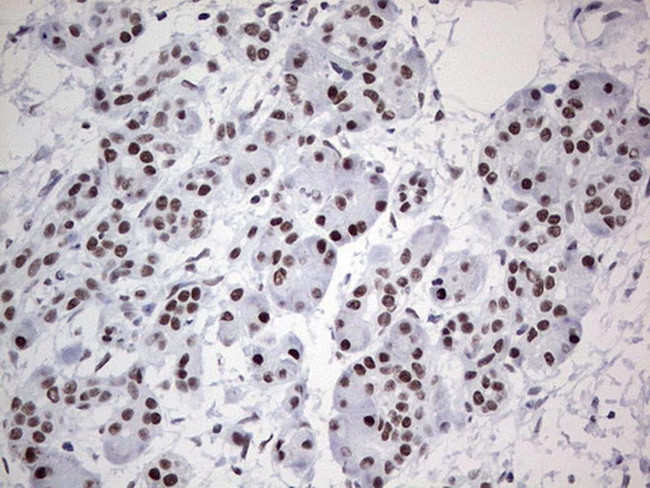 HDAC9 Antibody in Immunohistochemistry (Paraffin) (IHC (P))