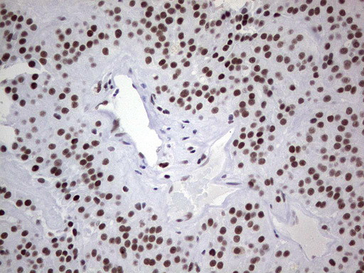 HDAC9 Antibody in Immunohistochemistry (Paraffin) (IHC (P))