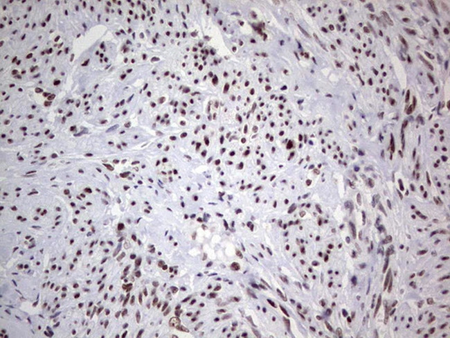 HDAC9 Antibody in Immunohistochemistry (Paraffin) (IHC (P))