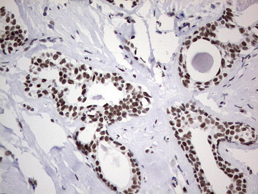 HDAC9 Antibody in Immunohistochemistry (Paraffin) (IHC (P))