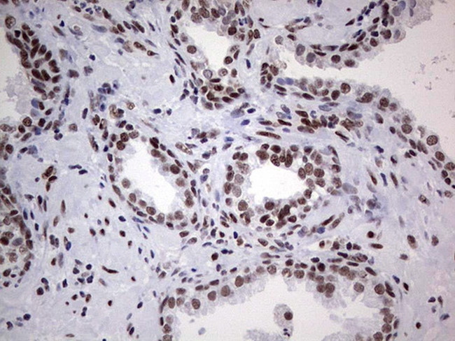 HDAC9 Antibody in Immunohistochemistry (Paraffin) (IHC (P))