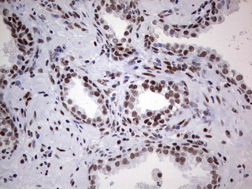 HDAC9 Antibody in Immunohistochemistry (Paraffin) (IHC (P))