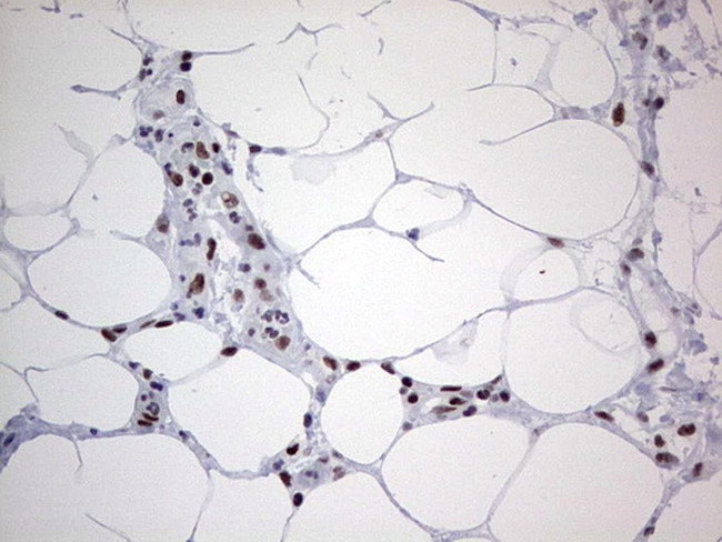 HDAC9 Antibody in Immunohistochemistry (Paraffin) (IHC (P))