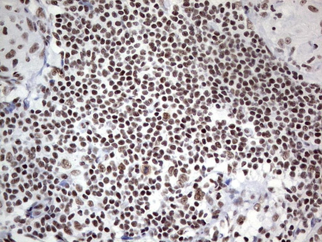 HDAC9 Antibody in Immunohistochemistry (Paraffin) (IHC (P))