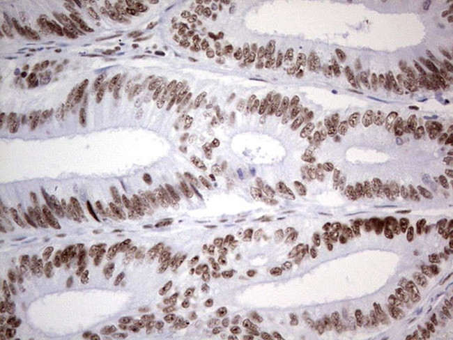 HDAC9 Antibody in Immunohistochemistry (Paraffin) (IHC (P))