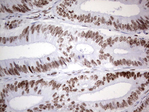 HDAC9 Antibody in Immunohistochemistry (Paraffin) (IHC (P))