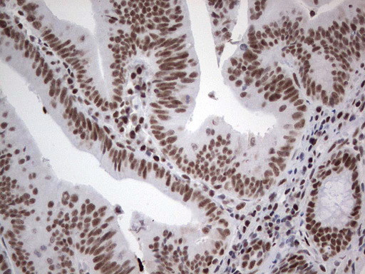 HDAC9 Antibody in Immunohistochemistry (Paraffin) (IHC (P))