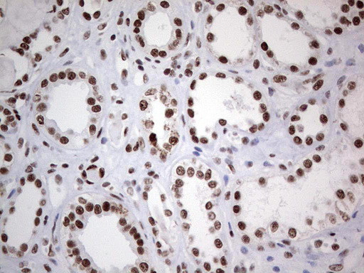 HDAC9 Antibody in Immunohistochemistry (Paraffin) (IHC (P))