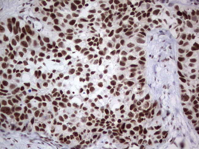 HDAC9 Antibody in Immunohistochemistry (Paraffin) (IHC (P))