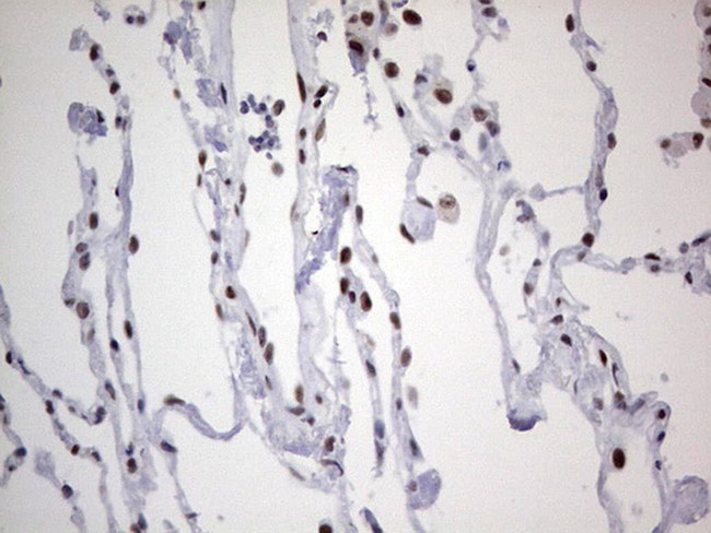 HDAC9 Antibody in Immunohistochemistry (Paraffin) (IHC (P))