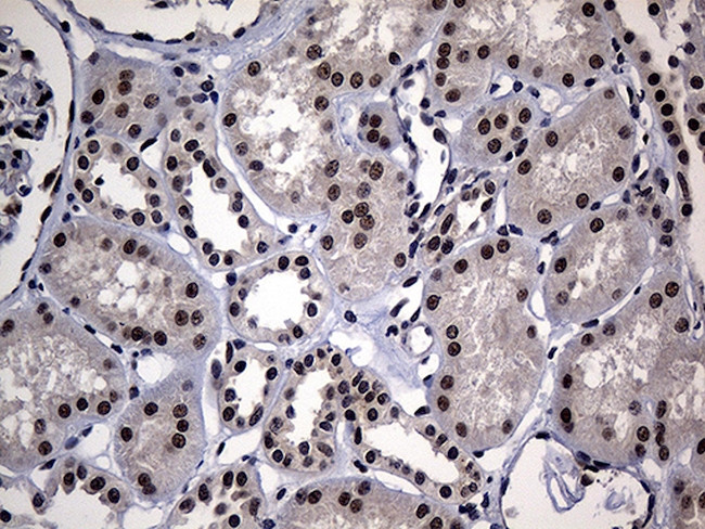 HDAC9 Antibody in Immunohistochemistry (Paraffin) (IHC (P))