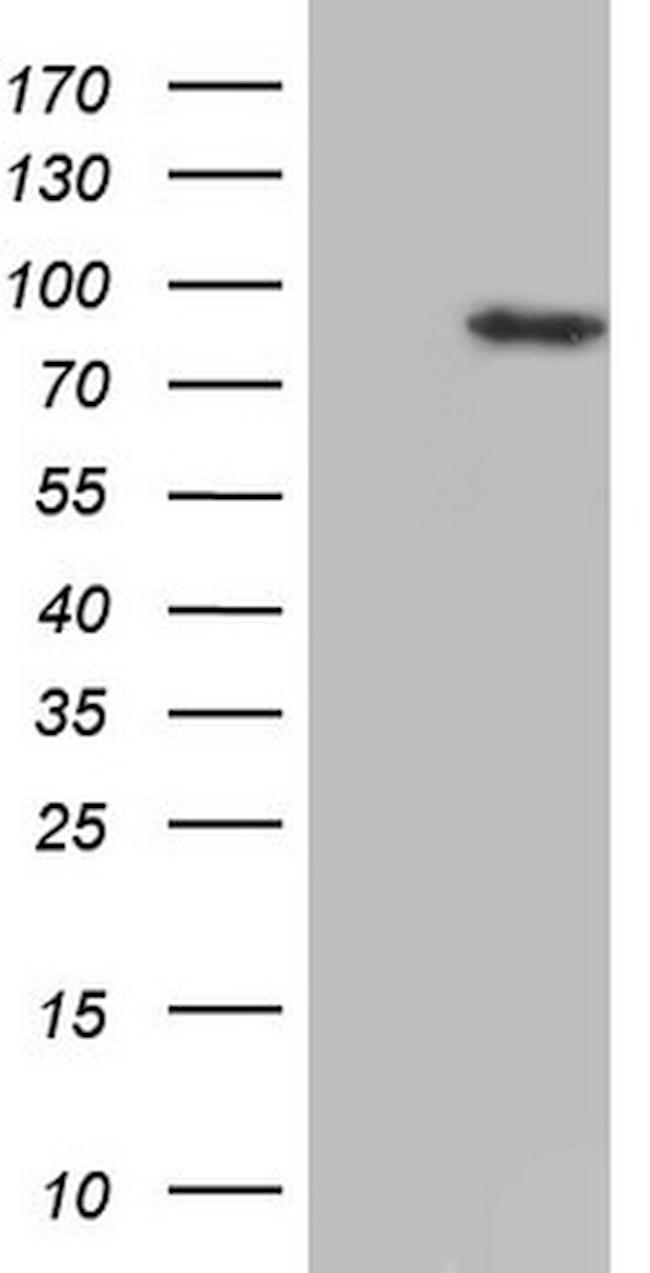 HDAC9 Antibody in Western Blot (WB)