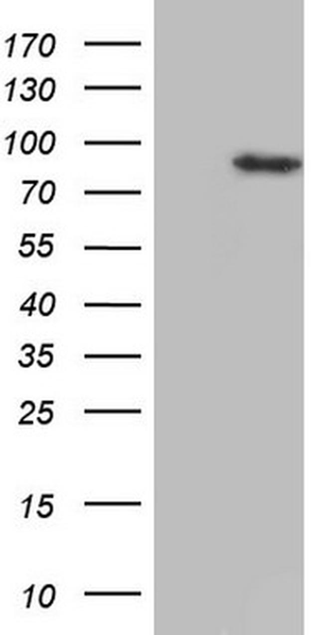 HDAC9 Antibody in Western Blot (WB)