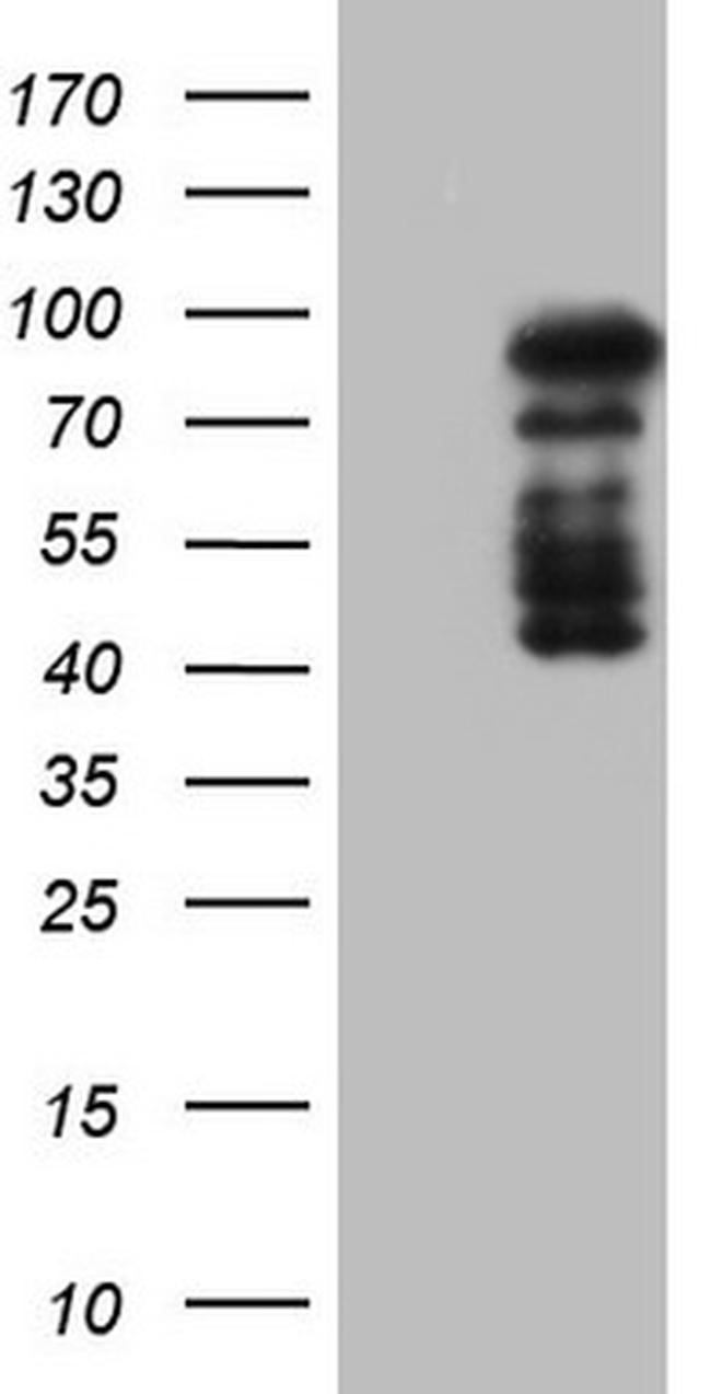 HDAC9 Antibody in Western Blot (WB)