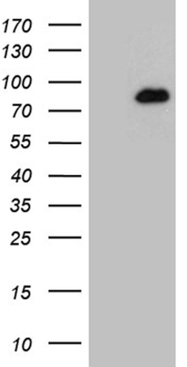 HDAC9 Antibody in Western Blot (WB)