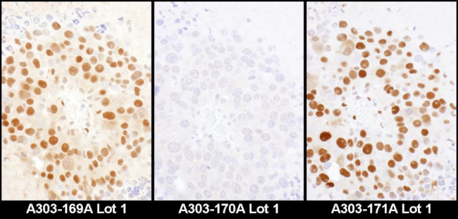 HDGF Antibody in Immunohistochemistry (IHC)