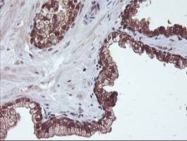 HDHD1 Antibody in Immunohistochemistry (Paraffin) (IHC (P))