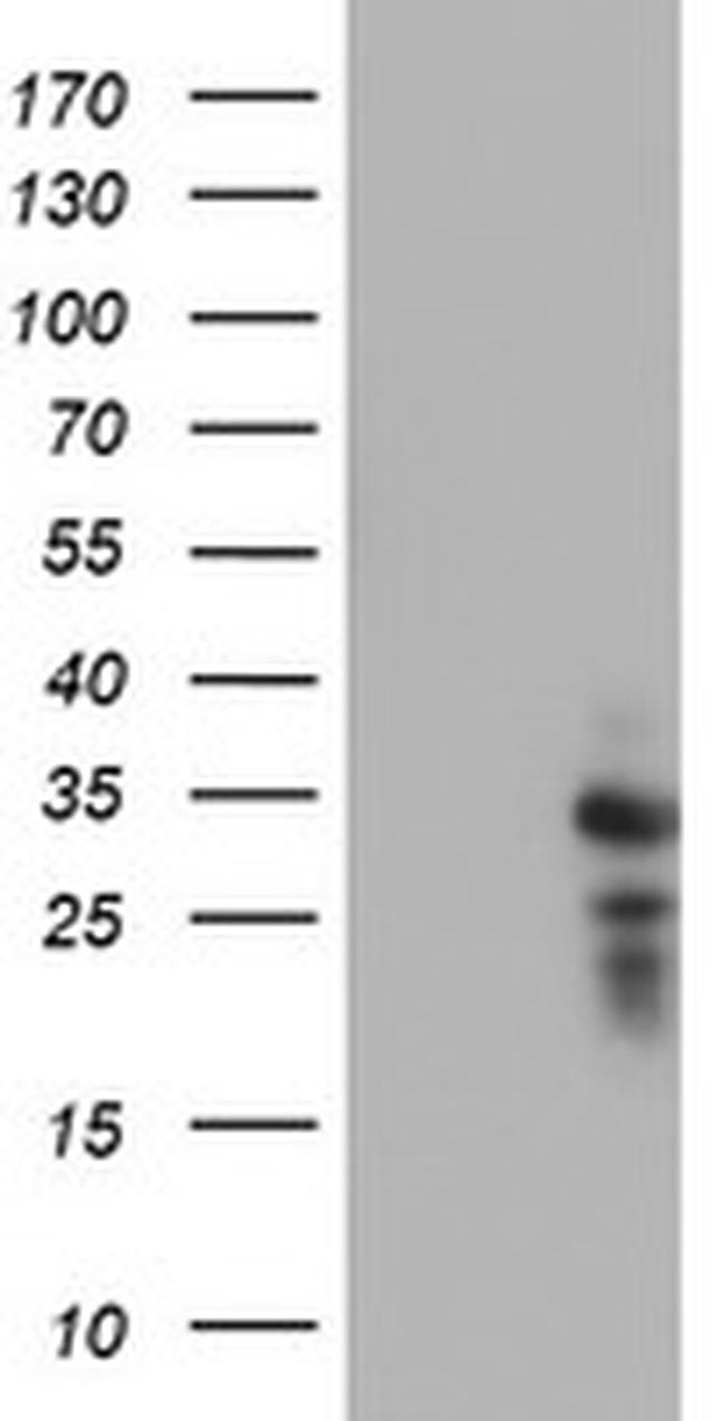 HDHD1 Antibody in Western Blot (WB)