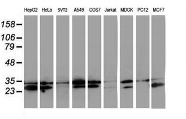 HDHD1 Antibody in Western Blot (WB)