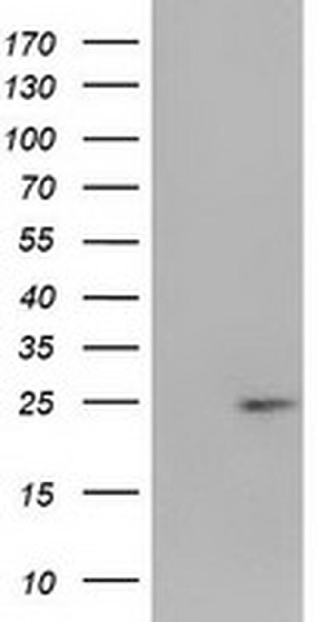 HDHD1 Antibody in Western Blot (WB)