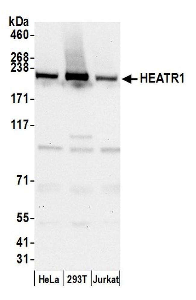 HEATR1/BAP28 Antibody in Western Blot (WB)