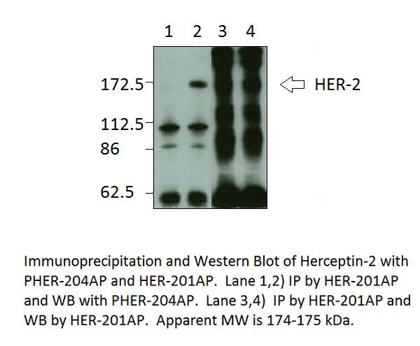 ErbB 2 Antibody in Western Blot (WB)