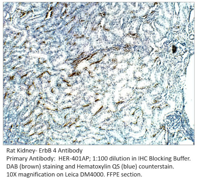 ErbB 4 Antibody in Immunohistochemistry (IHC)