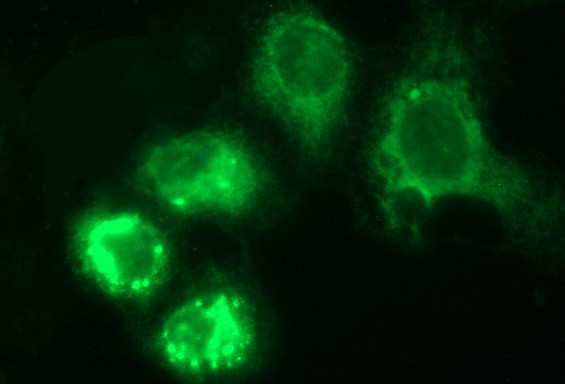 HERPUD1 Antibody in Immunocytochemistry (ICC/IF)