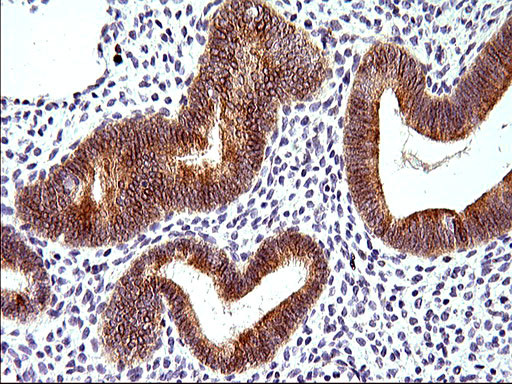 HERPUD1 Antibody in Immunohistochemistry (Paraffin) (IHC (P))