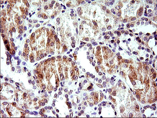 HERPUD1 Antibody in Immunohistochemistry (Paraffin) (IHC (P))