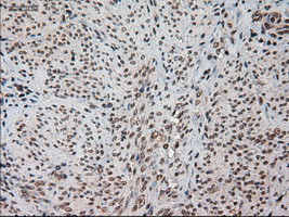 HES1 Antibody in Immunohistochemistry (Paraffin) (IHC (P))