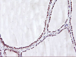 HES1 Antibody in Immunohistochemistry (Paraffin) (IHC (P))